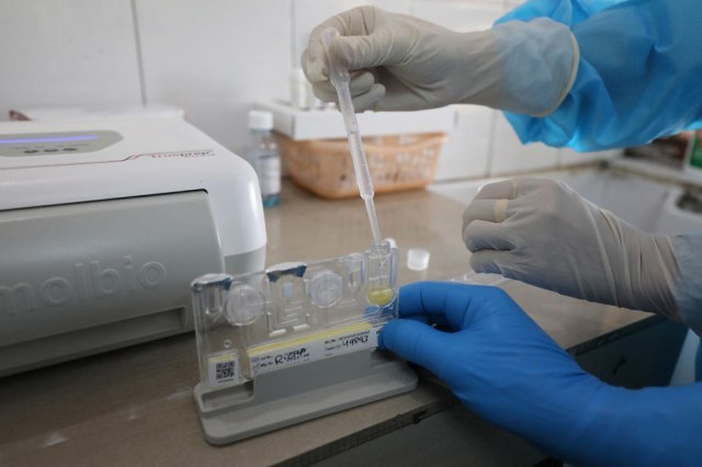 Uskoro u Srbiji novi centar za praæenje mutacija koronavirusa